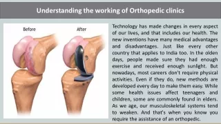Understanding the working of Orthopedic clinics