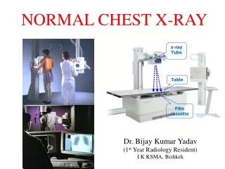 NORMAL CHEST X-RAY