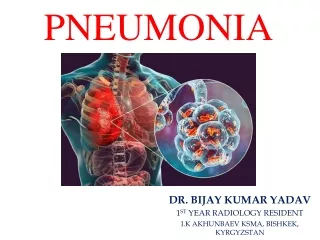 Pneumonia Radiology