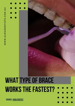 How Fast Dental Braces Treatment Work?