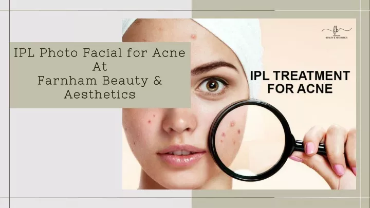 ipl photo facial for acne at farnham beauty