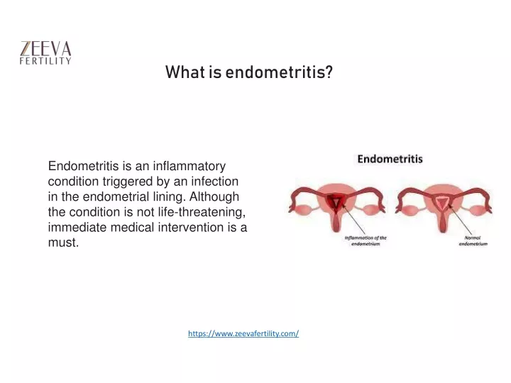 what is endometritis