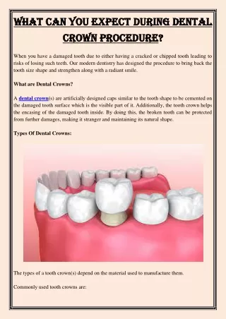 what can you expect during dental what