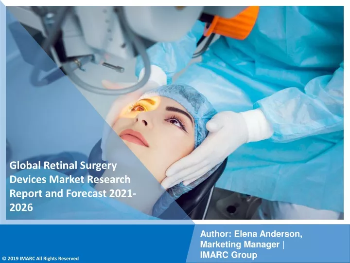 global retinal surgery devices market research