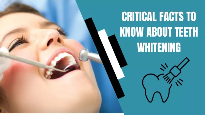 critical facts to know about teeth whitening