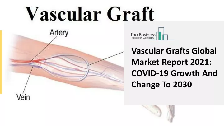 vascular grafts global market report 2021 covid