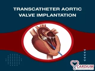 Transcatheter Aortic Valve Implantation (TAVI) | Surgical Procedure