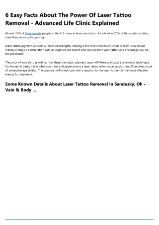 6 easy facts about the power of laser tattoo