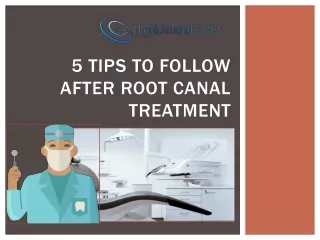 5 Tips to Follow After Root Canal Treatment