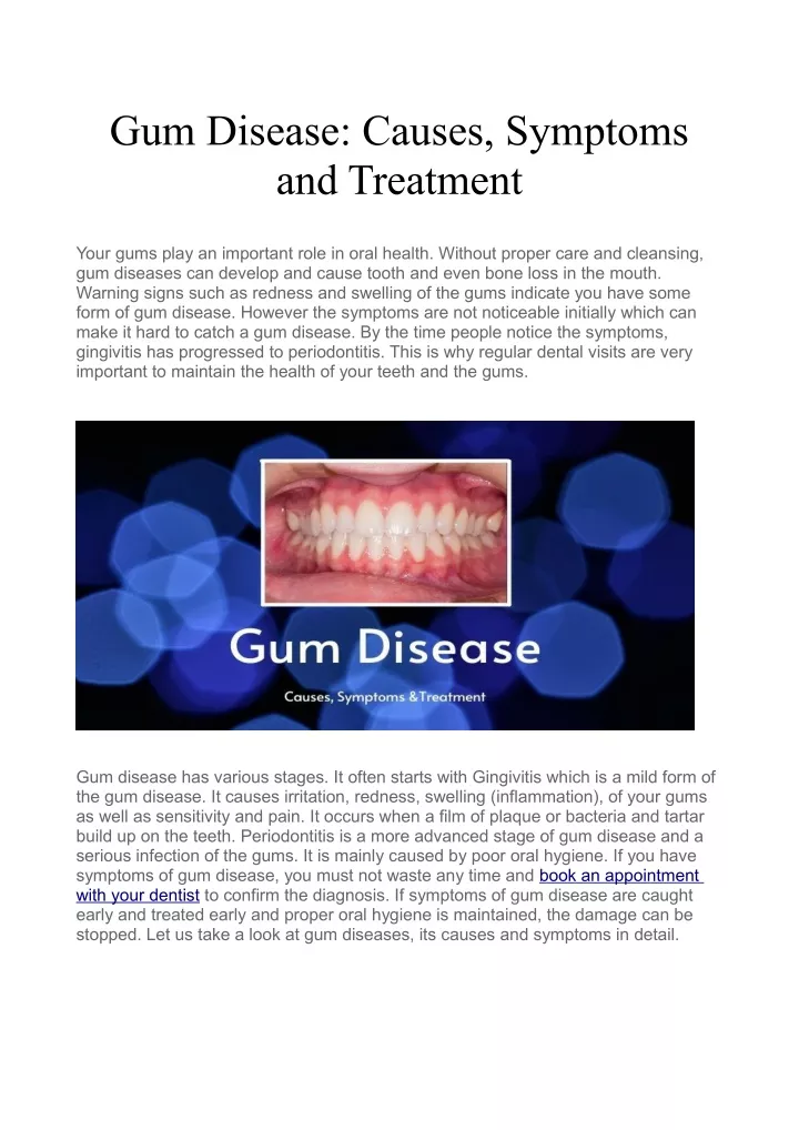 gum disease causes symptoms and treatment