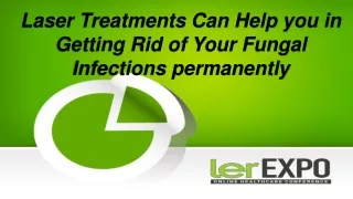 Laser Treatments Can Help you in Getting Rid of Your Fungal Infections permanently