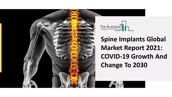 spine implants global market report 2021 covid