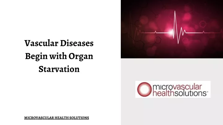 vascular diseases begin with organ starvation