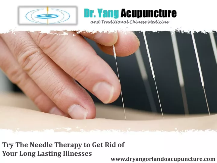 try the needle therapy to get rid of your long