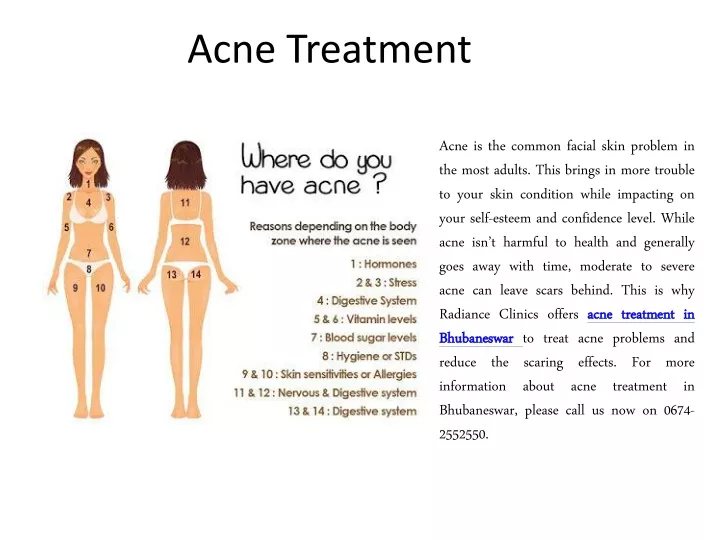 acne treatment