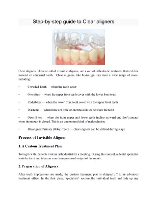 step by step guide to clear aligners