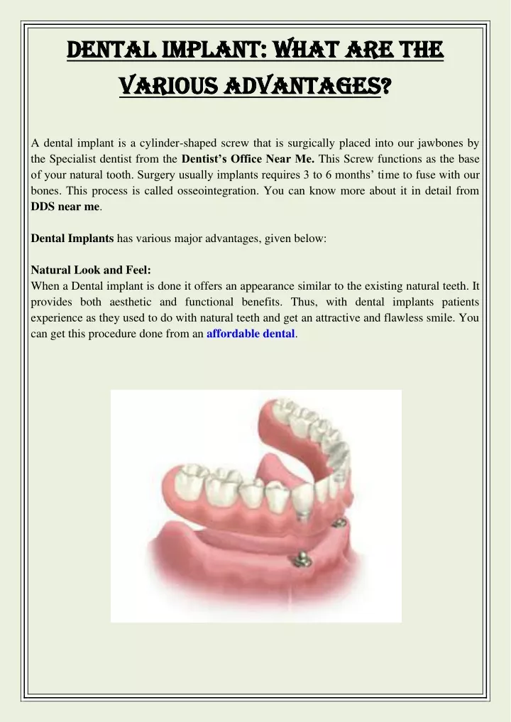 dental implant what are the dental implant what