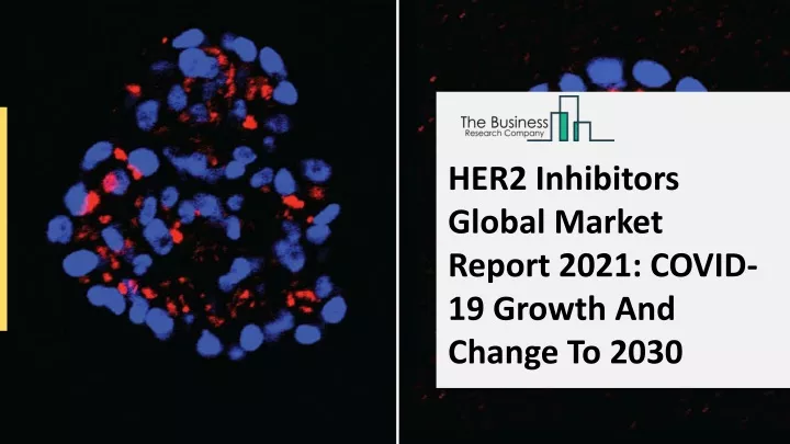 her2 inhibitors global market report 2021 covid