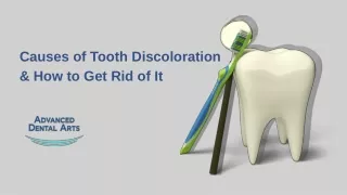 Causes of Tooth Discoloration and How to Get Rid of It - 24th June 2021 - DrNathanielChan