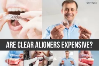 Are Clear Aligners Expensive? | Clear Aligners Cost | OrthoFX