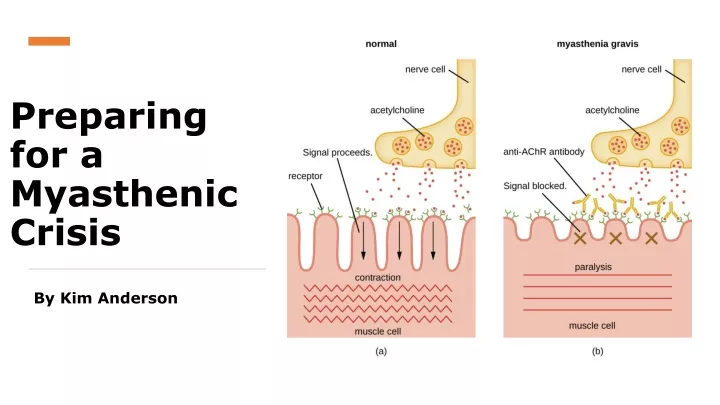 preparing for a myasthenic crisis