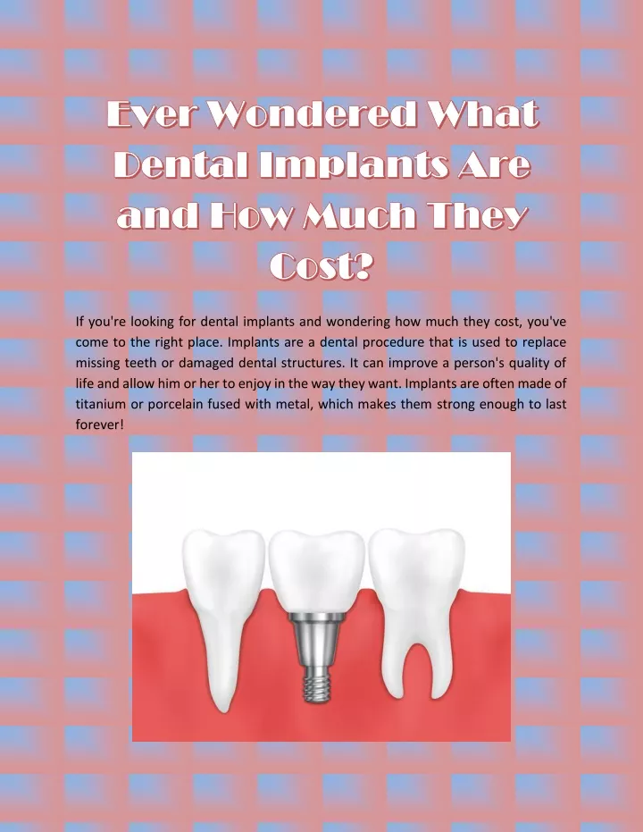 if you re looking for dental implants