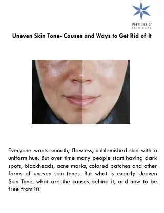 uneven skin tone causes and ways to get rid of it