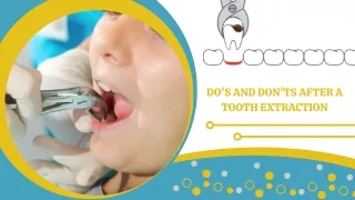 Do's and Don'ts After a Tooth Extraction