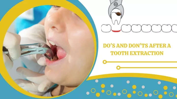 do s and don ts after a tooth extraction