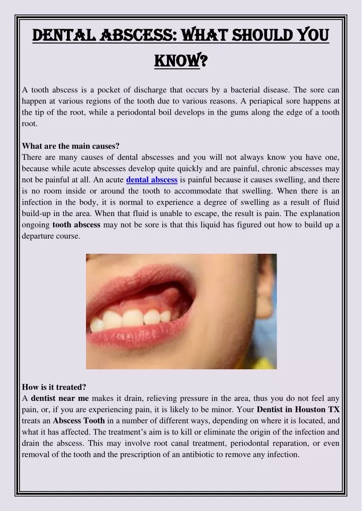 dental abscess what should you dental abscess