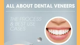 How to Find Out if Dental Veneers are the Right Choice for You
