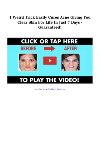 1 Weird Trick Easily Cures Acne Giving You Clear Skin For Life In Just 7 Days -