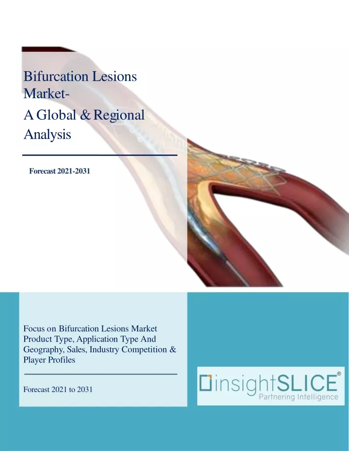 bifurcation lesions market