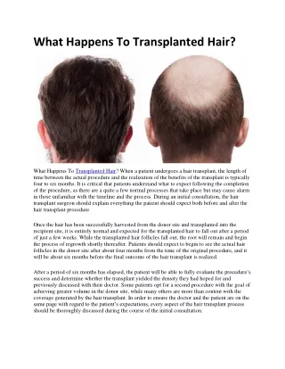 What Happens To Transplanted Hair?