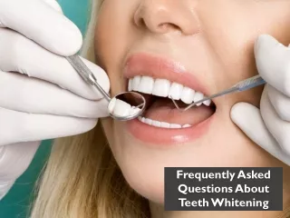 Teeth Whitening Commonly Asked Questions