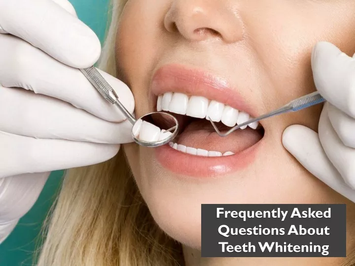 frequently asked questions about teeth whitening