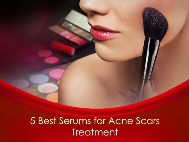 5 best serums for acne scars treatment