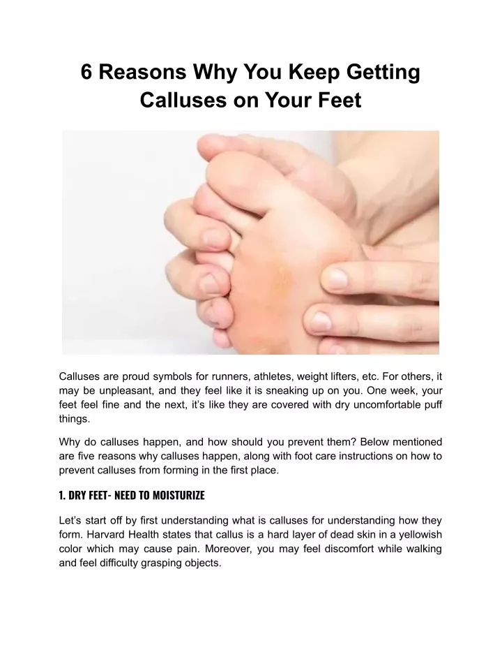 6 reasons why you keep getting calluses on your