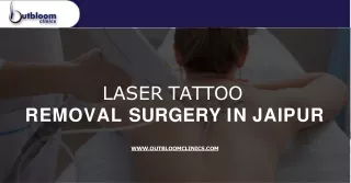 Are you looking Laser tattoo removal surgery in Jaipur? - Outbloom Clinics