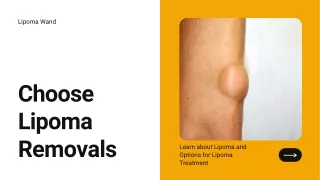 Lipoma Removals- Get Your Lipoma Wand Today