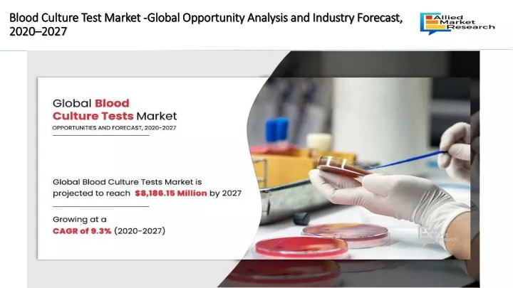 blood culture test market global opportunity analysis and industry forecast 2020 2027