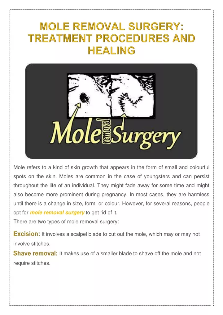 mole refers to a kind of skin growth that appears