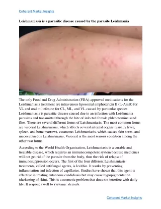 Leishmaniasis Treatment