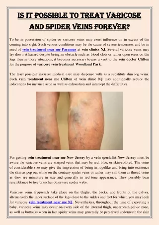 Is It Possible To Treat Varicose and Spider Veins Forever