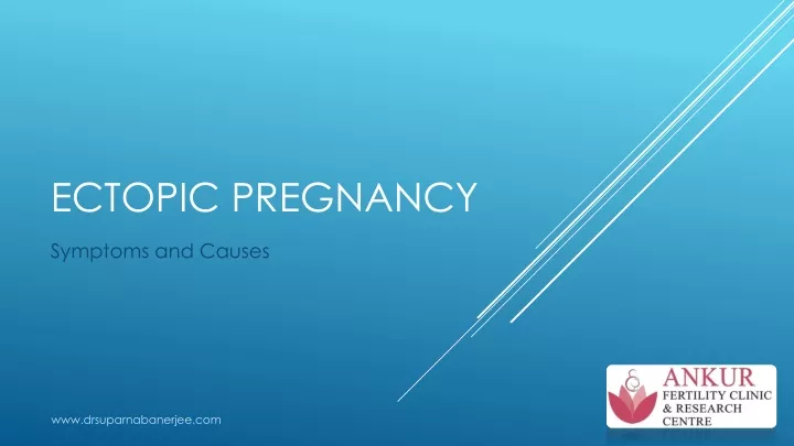 ectopic pregnancy