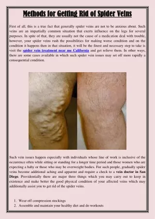 methods for getting rid of spider veins methods