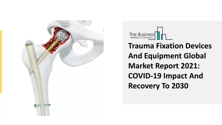 trauma fixation devices and equipment global