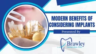 Modern Benefits Of Considering Implants
