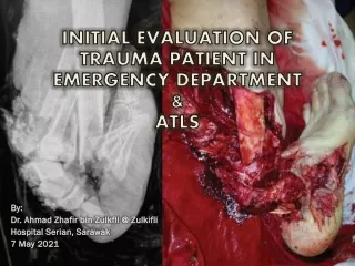Initial Evaluation of Trauma Patient in Emergency Department and ATLS