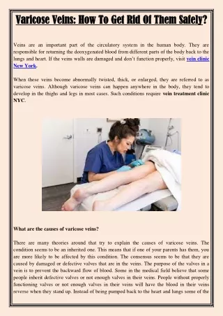 varicose veins how to get rid of them safely